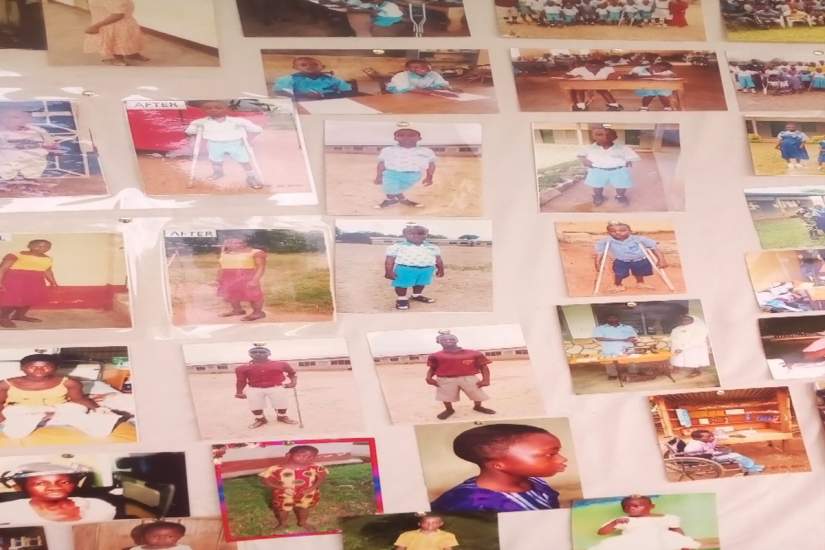 A collection of photos from Ancilla Community Based Rehabilitation (ACBR), Ghana, show 